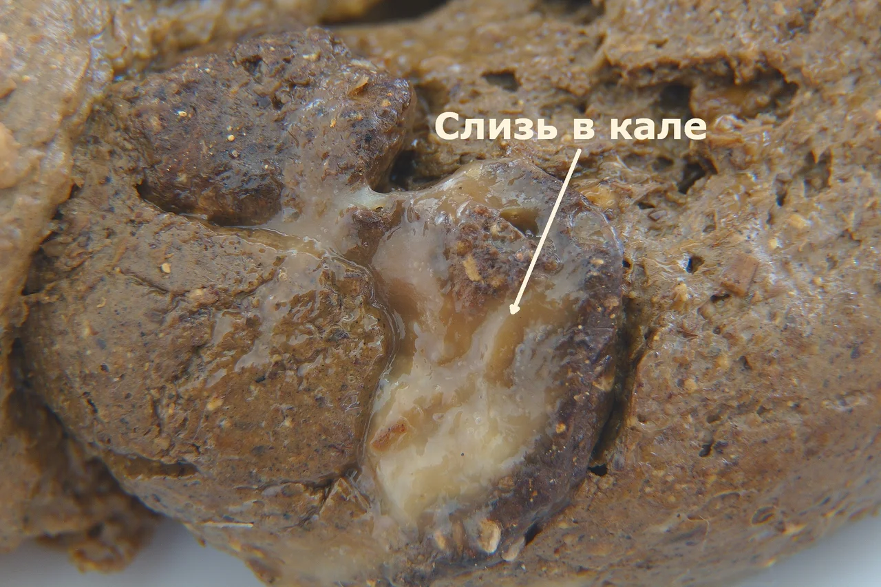 Слизь в кале после бананов
