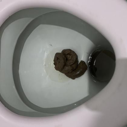 понос