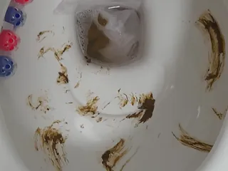 Унитаз в говне