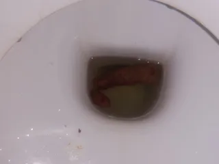 Болезненный алый цвет