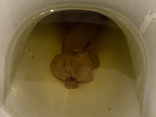Говнопенис