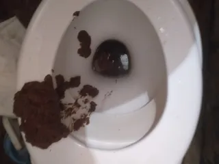 Понос