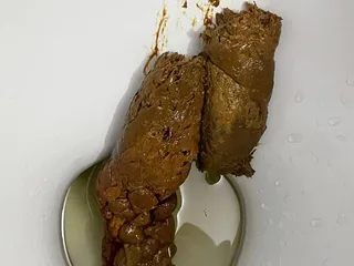 ТИНИ