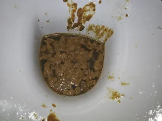 Diarrhea