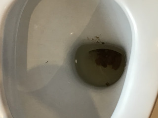 Ребёнок хорошо покакал
