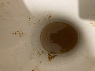 Водяной понос