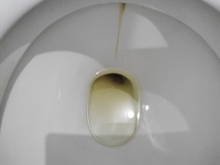 Запор
