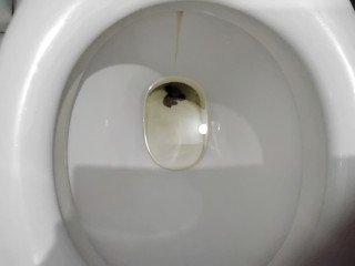 Запор