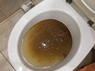 Засорило толчок