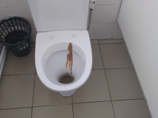 Супер клей