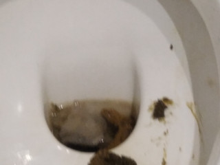 Понос