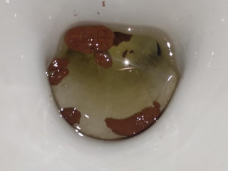 Крольчатина