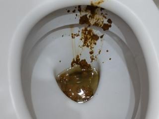 Запоносил