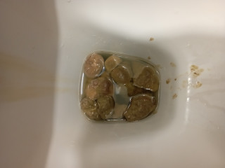 Козья 
