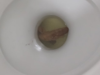 Не срал один день